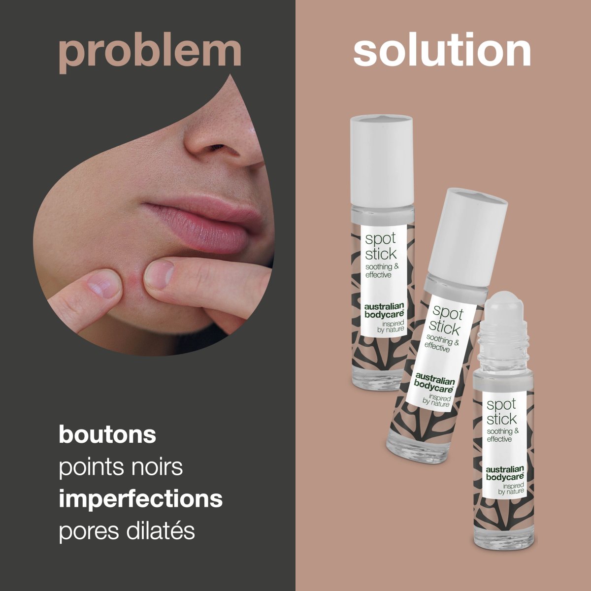 3 x stick anti boutons à l'huile de tea tree pour les boutons et les points noirs — efficace contre les boutons, les impuretés et les points noirs. – Image 3