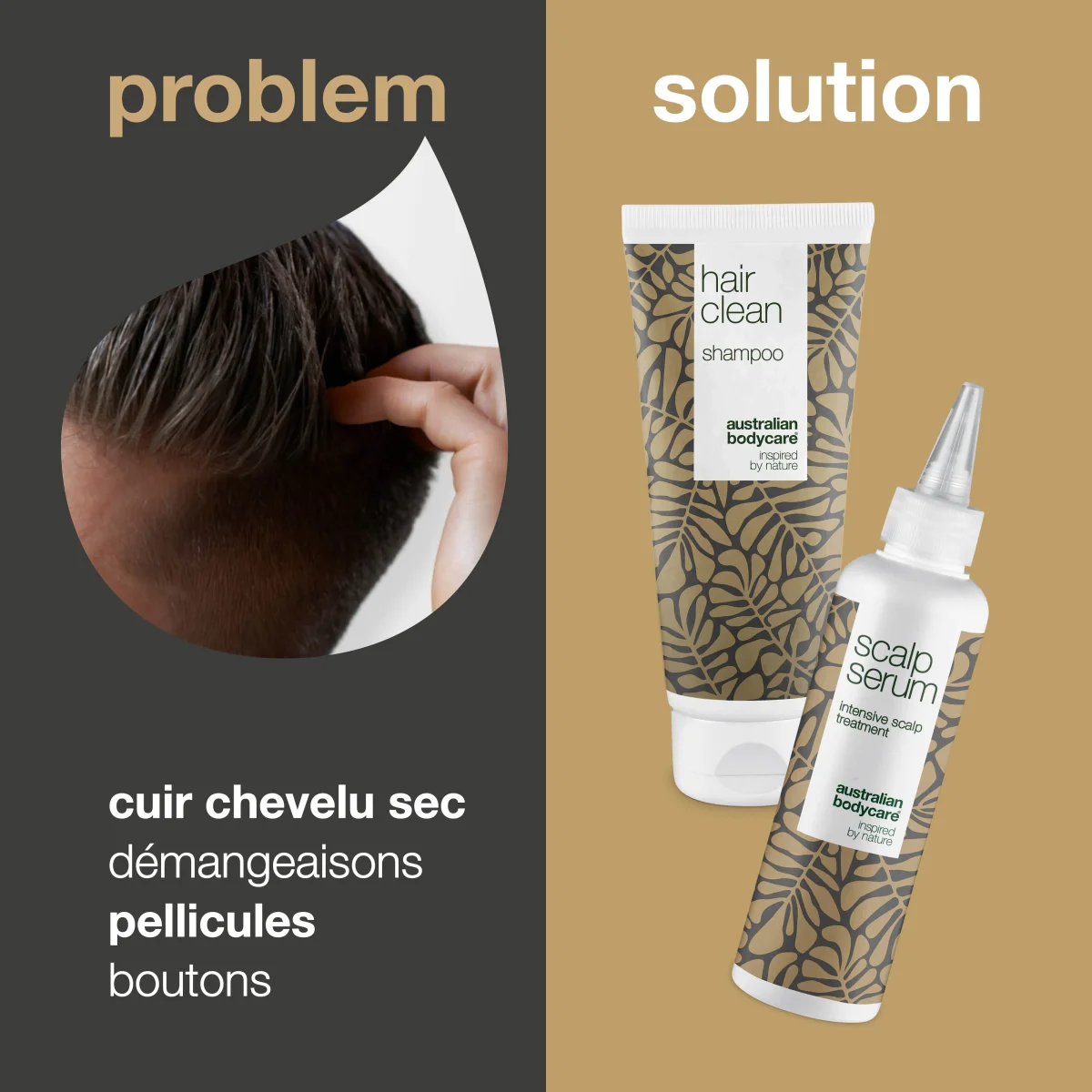 Kit pour pellicules, cuir chevelu sec et démangeaisons — 2x produits contre les pellicules, cuir chevelu sec et démangeaisons – Image 3