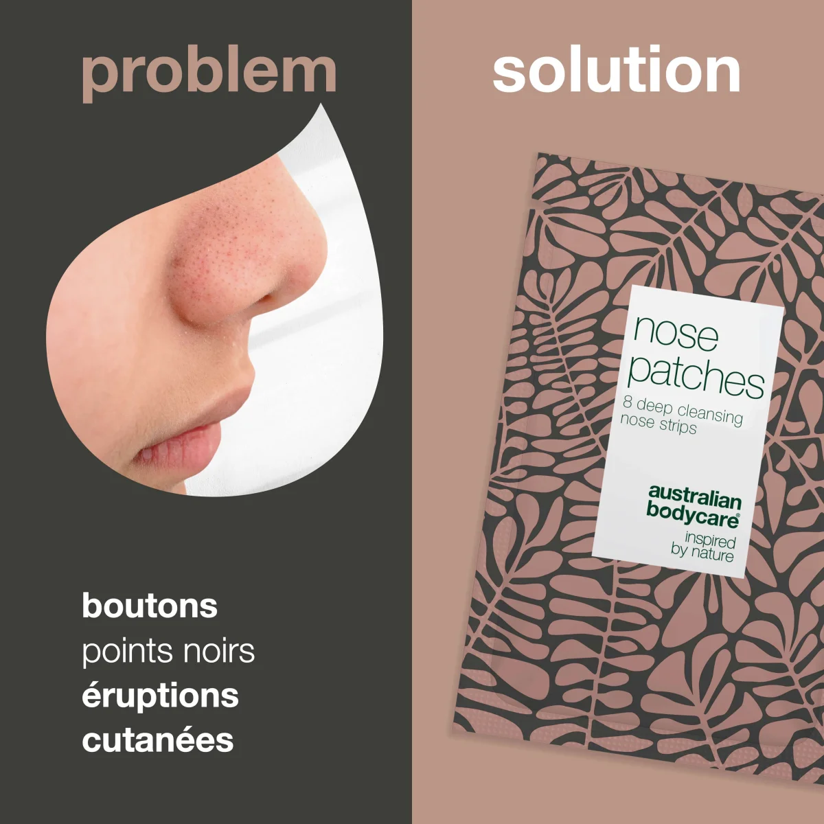 Patchs pour le nez – élimine boutons, points noirs et impuretés — Nose patches qui éliminent boutons, points noirs et impuretés. Nettoie les pores en profondeur pour une peau lisse et saine. – Image 3